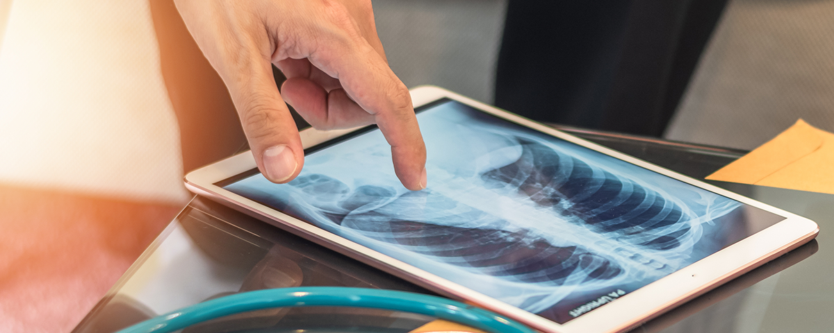 Lung x-ray on iPad