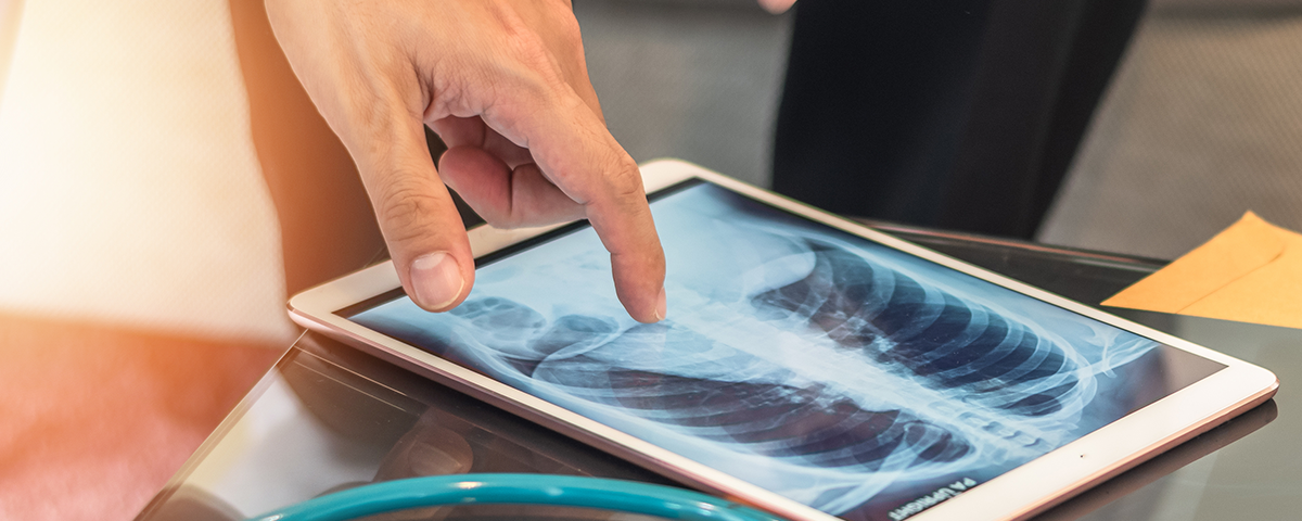 Lung x-ray on iPad